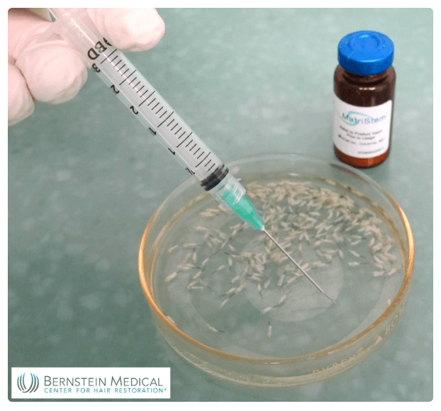 Hair cloning in early 2000's