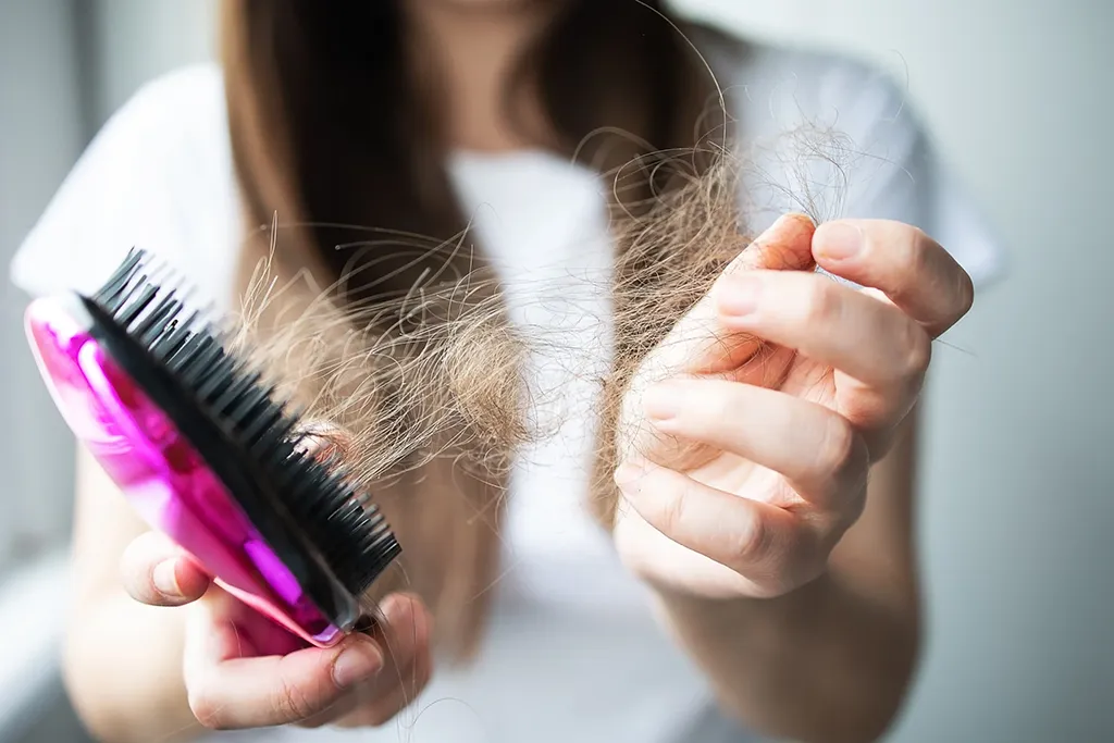 Woman holding a thick clump of hair pulled from her brush, showing significant hair shedding